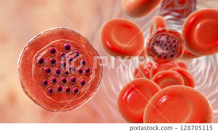The malaria-infected red blood cells 128705115