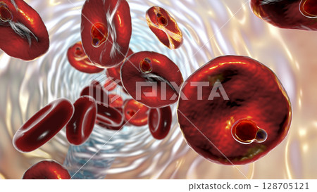 The malaria-infected red blood cells 128705121