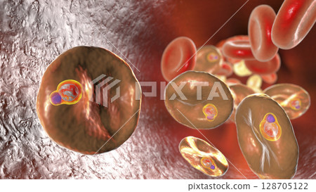Babesia parasites inside red blood cell, the causative agent of babesiosis Babesia parasites inside red blood cell, the causative agent of babesiosis 128705122