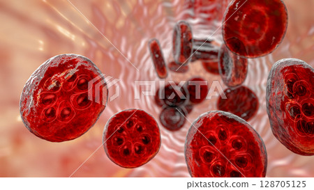 The malaria-infected red blood cell 128705125