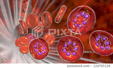 The malaria-infected red blood cell 128705126