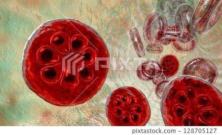 The malaria-infected red blood cell 128705127
