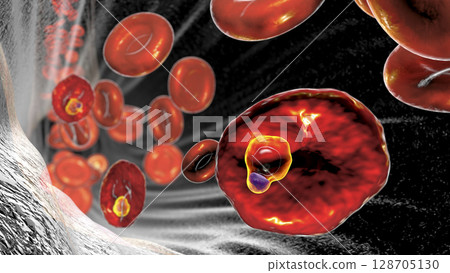 The malaria-infected red blood cell 128705130