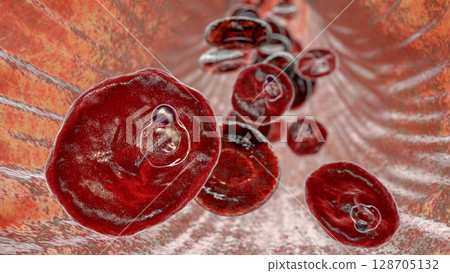 The malaria-infected red blood cell 128705132