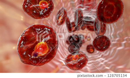 The malaria-infected red blood cell 128705134