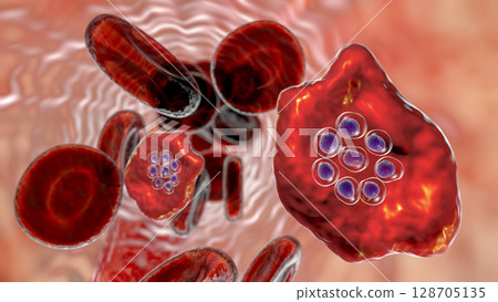The malaria-infected red blood cells 128705135