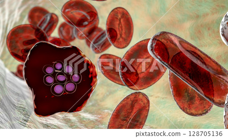 The malaria-infected red blood cells 128705136