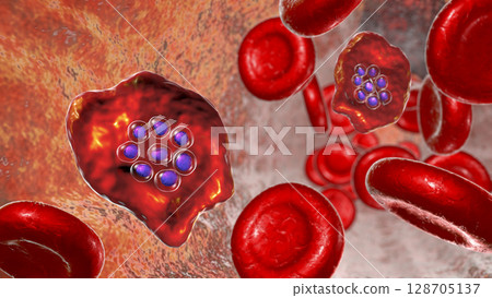 The malaria-infected red blood cells The malaria-infected red blood cells 128705137