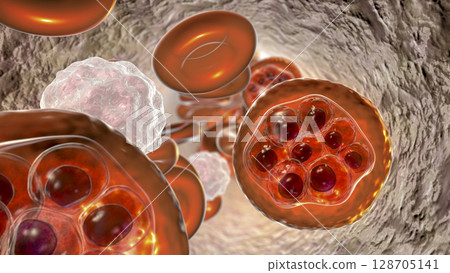 Red blood cell infected with malaria parasite 128705141