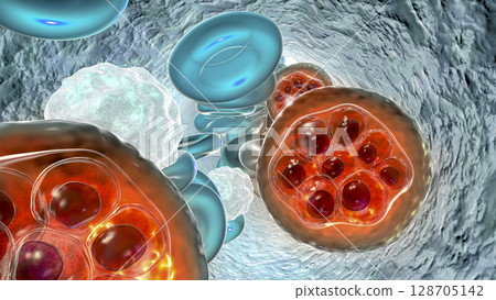 Red blood cell infected with malaria parasite 128705142