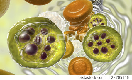 Red blood cell infected with malaria parasite 128705146