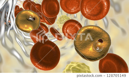 Red blood cell infected with malaria parasite Plasmodium vivax, ring stage 128705149