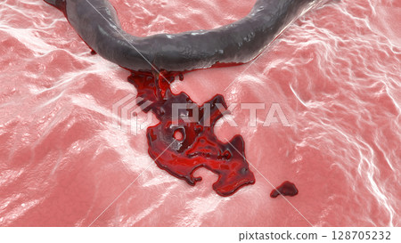 Hemorrhage, blood flowing from the damaged blood vessel, 3D illustration 128705232