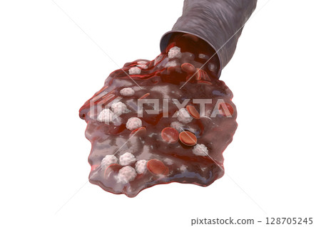 Blood flow, hemorrhage 128705245