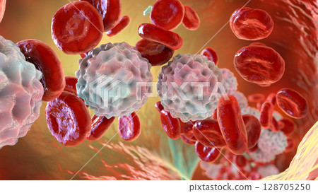 Lymphocytosis, illustration showing abundant white blood cells Lymphocytosis, illustration showing abundant white blood cells 128705250
