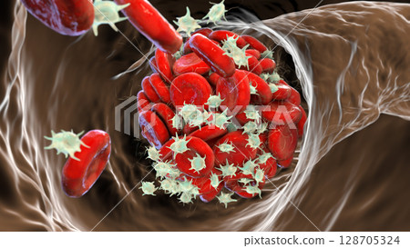 Blood clot made of red blood cells, platelets and fibrin protein strands 128705324