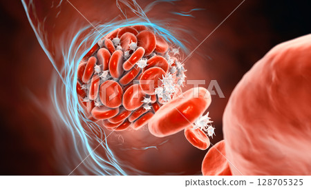 Blood clot made of red blood cells, platelets and fibrin protein strands 128705325