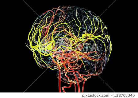 Brain arteries with highlighted middle cerebral artery in yellow, 3D illustration Brain arteries with highlighted middle cerebral artery in yellow, 3D illustration 128705340
