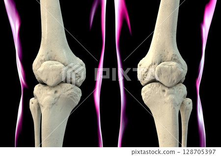 Knee bones anatomy, 3D illustration Knee bones anatomy, 3D illustration 128705397