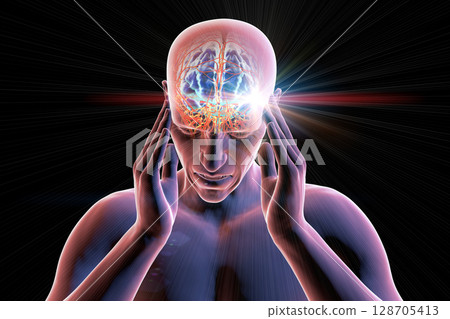 Headache, 3D illustration Headache, 3D illustration 128705413
