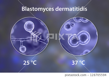 Blastomyces dermatitidis fungi Blastomyces dermatitidis fungi 128705594