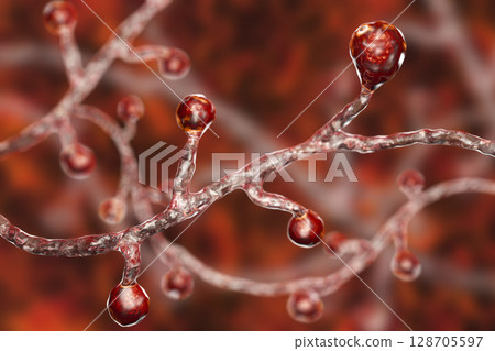 Blastomyces dermatitidis fungi 128705597