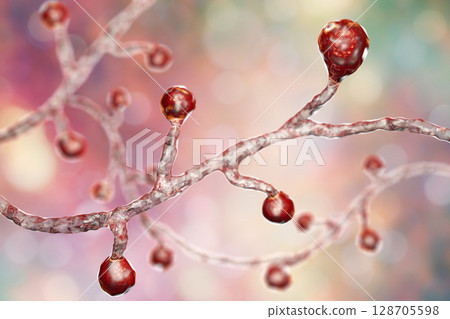 Blastomyces dermatitidis fungi 128705598