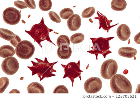 Acanthocytes, abnormal red blood cells with thorn-like projections Acanthocytes, abnormal red blood cells with thorn-like projections 128705621
