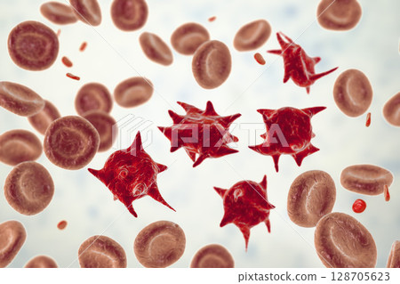 Acanthocytes, abnormal red blood cells with thorn-like projections 128705623