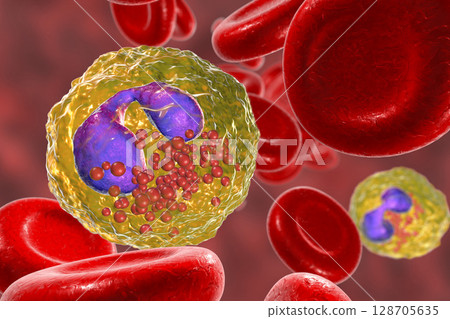 Eosinophil in blood, a white blood cell Eosinophil in blood, a white blood cell 128705635