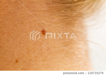 Small mole on woman neck 128710274