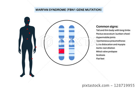 Marfan syndrome poster 128719955