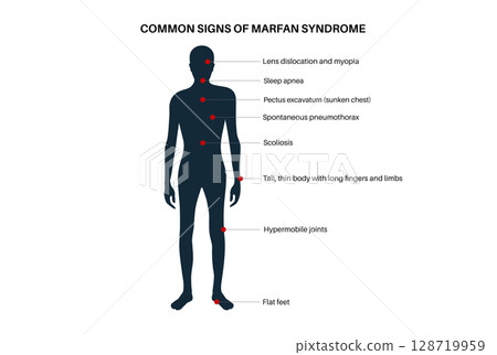 Marfan syndrome poster 128719959