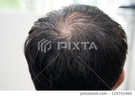 Bald in the middle head and begin no loss hair glabrous of mature Asian business smart active office man. Bald in the middle head and begin no loss hair glabrous of mature Asian business smart active office man. 128742866