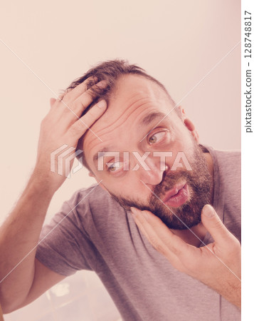 Worried man looking at his decreasing hairline 128748817