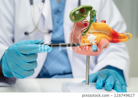 Pancreatitis, pancreatic cancer, Asian doctor with pancreas, gallbladder and bile duct human anatomy model at hospital. Pancreatitis, pancreatic cancer, Asian doctor with pancreas, gallbladder and bile duct human anatomy model at hospital. 128749627
