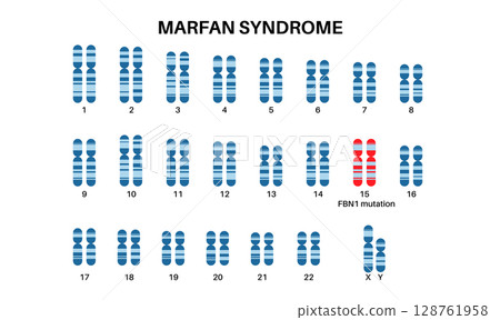 Marfan syndrome poster 128761958