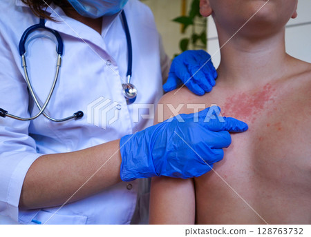 A boy with a red rash is being checked by the physician. A boy with a red rash is being checked by the physician. 128763732