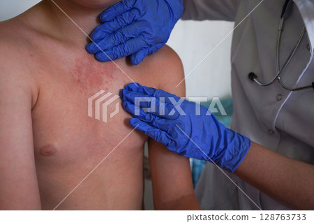 The child's skin has a rash that the doctor is investigating. The child's skin has a rash that the doctor is investigating. 128763733