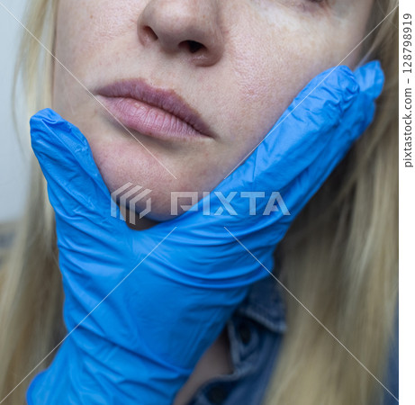 A dermatologist examines a woman's face with dilated pores, pigmentation, and sebaceous filaments. Treatment of rosacea and skin inflammation. A dermatologist examines a woman's face with dilated pores, pigmentation, and sebaceous filaments. Treatment of rosacea and skin inflammation. 128798919