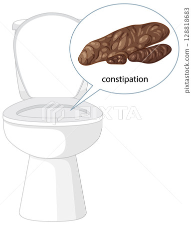 Constipation Illustration with Toilet and Stool Graphic 128818683