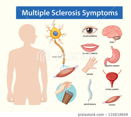 Multiple Sclerosis Symptoms Medical Vector Illustration 128818689