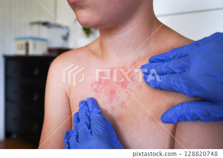 The doctor is assessing the boy's skin for signs of infectious diseases. The doctor is assessing the boy's skin for signs of infectious diseases. 128820748