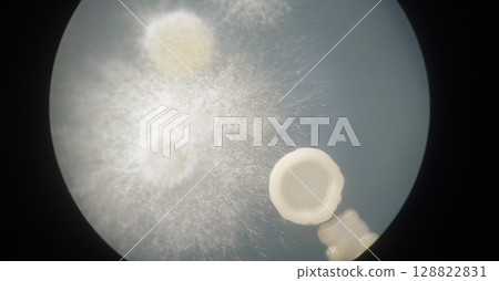 Yeast and mold colonies 128822831