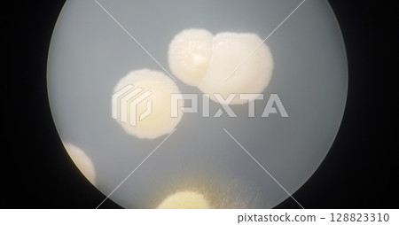 Observation of colony morphology 128823310