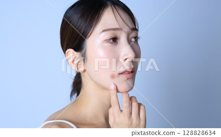 Acne, image of a woman suffering from rough skin Acne, image of a woman suffering from rough skin 128828634