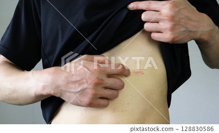 一個人捲起衣服，抓身體 128830586