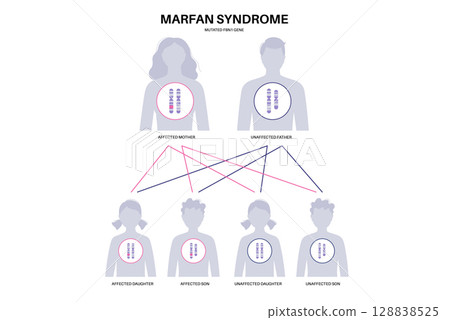 Marfan syndrome poster Marfan syndrome poster 128838525