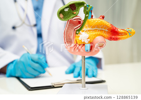 Pancreatitis, pancreatic cancer, Asian doctor with pancreas, gallbladder and bile duct human anatomy model at hospital. 128865139