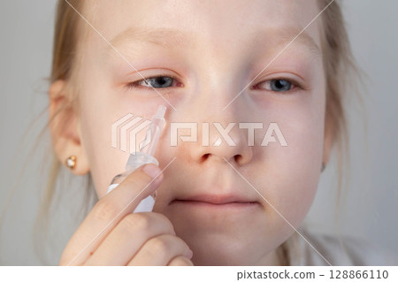 A caucasian girl holds eye drops near her face, close-up. Disease concept conjunctivitis and dry eye syndrome, viral and bacterial infection, allergy A caucasian girl holds eye drops near her face, close-up. Disease concept conjunctivitis and dry eye syndrome, viral and bacterial infection, allergy 128866110